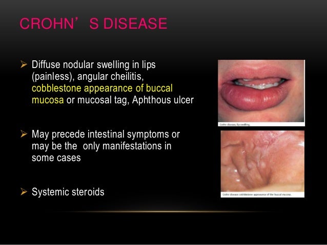 chrons disease vaginal Taboo toons tgp